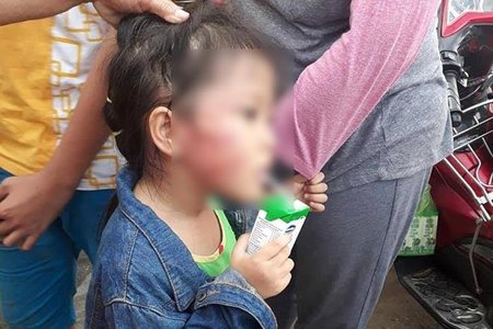Bắt khẩn cấp bảo mẫu đánh bé gái 5 tuổi sưng mặt