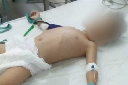 Bé trai 5 tuổi bị người tình của mẹ bạo hành đến hôn mê, nguy kịch