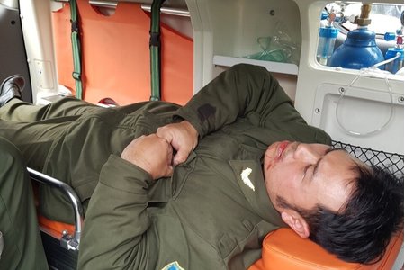 Giám định thương tật nhân viên sân bay Nội Bài bị đánh gãy răng