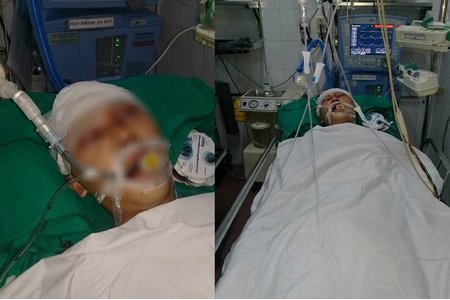 Hà Nội: Nam học sinh bị đánh chấn thương sọ não ở gần nhà