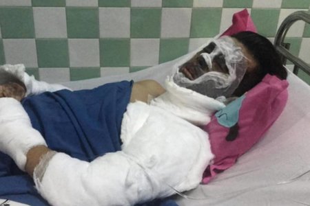 Tình tiết mới nhất vụ đôi nam nữ Việt kiều bị tạt axit, cắt gân chân 