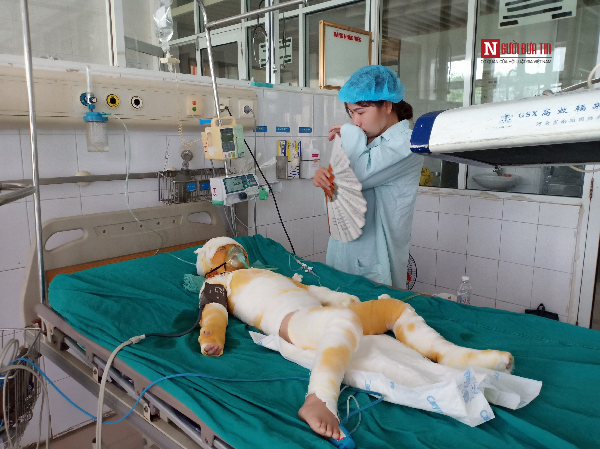 Vụ 3 trẻ mầm non bị bỏng cồn nặng ở Hà Nam: Tiết học kỹ năng sống nằm trong chương trình của Bộ