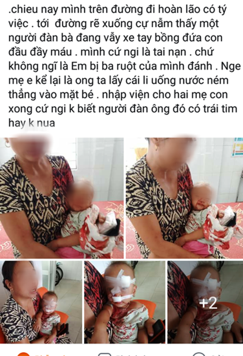 Xác minh thông tin bé 2 tuổi bị bố ném ly trúng mặt, khâu 12 mũi