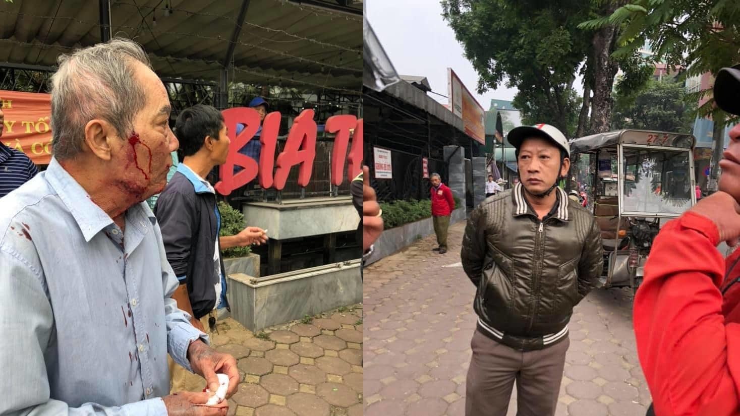 Cụ ông 80 tuổi ở Hà Nội bị gã xe ôm đánh, bắn súng cao su vào mặt