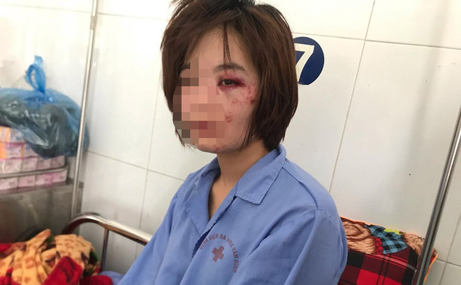 Truy nã 2 đối tượng đánh nữ nhân viên xe buýt đúng ngày phụ nữ Việt Nam