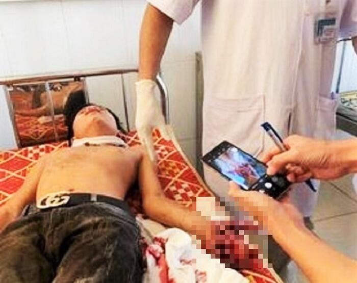 Hà Tĩnh: Đang học bài, laptop bất ngờ phát nổ khiến 3 học sinh nhập viện cấp cứu