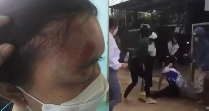 Nữ sinh lớp 11 bị nhóm người đánh hội đồng dã man trước cổng trường