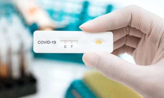 Khẩn: Có tình trạng người dân tự xét nghiệm nhanh, dương tính với COVID-19 nhưng không thông báo, Bộ Y tế yêu cầu các địa phương rà soát