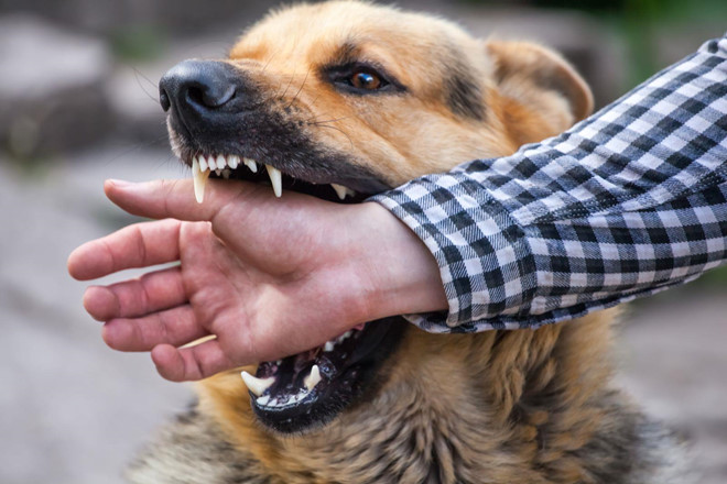 Cần siết chặt hơn quy định nuôi, nhốt thú cưng sau hàng loạt vụ chó tấn công người