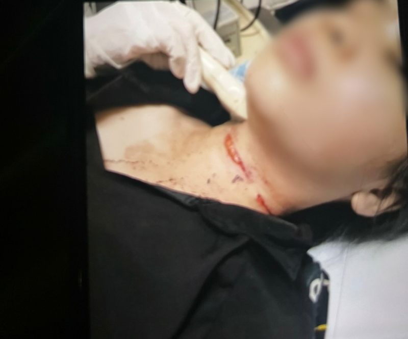 Bình Dương: Cô gái tự cắt cổ rồi báo bị tấn công, cướp tài sản
