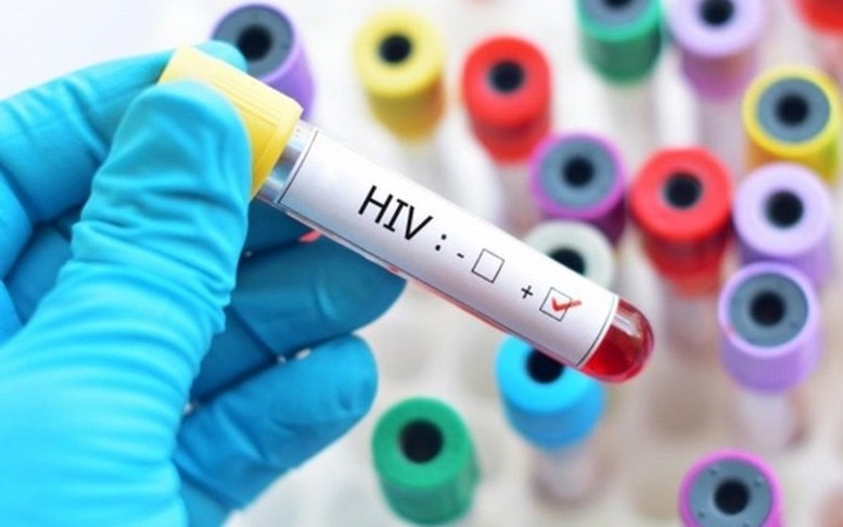 hiv-1783599861.jpg