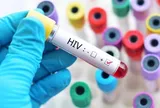 Quy định mới về cấp giấy chứng nhận bị phơi nhiễm HIV do tai nạn rủi ro nghề nghiệp