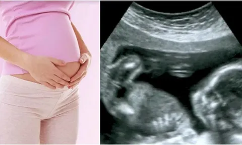 Tiết lộ giới tính thai nhi trái quy định có thể bị phạt tới 15 triệu đồng