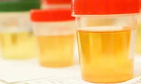 Niệu liệu pháp sống lại