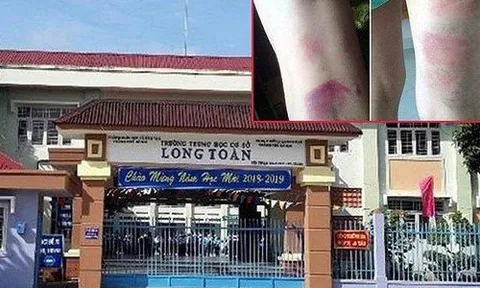 Sở GDĐT Bà Rịa-Vũng Tàu ban hành văn bản vụ cô giáo đánh học sinh bầm tím