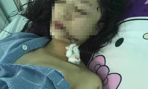 Nguyên nhân khiến thiếu nữ 18 tuổi bị rạch mặt dã man ở Bắc Ninh