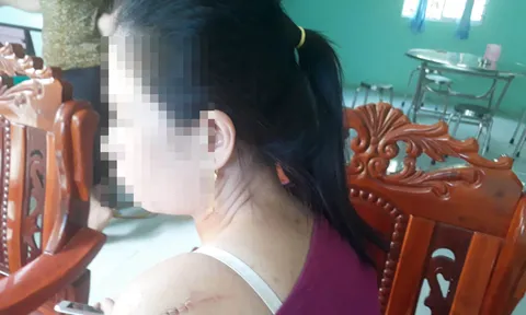 Tình hình sức khỏe các nạn nhân trong vụ cô dâu bị chồng cũ chém trong ngày cưới?