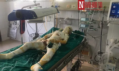 Nạn nhân thứ 4 tử vong trong vụ phóng hỏa giết người ở Sơn La