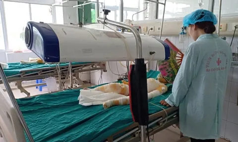 Vụ cô giáo dùng cồn dạy PCCC khiến 3 trẻ bị bỏng: Các nạn nhân tiên lượng xấu
