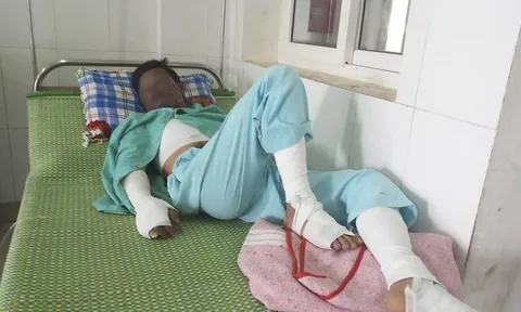 Sử dụng điện thoại khi đang sạc pin, một thanh niên bị bỏng nặng