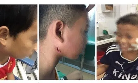 Biểu hiện bệnh, con đường lây truyền và cách phòng ngừa vi khuẩn 'ăn thịt người'