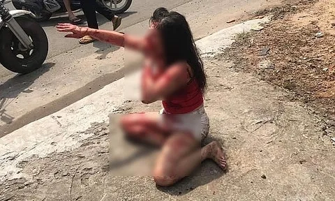 Nữ tiếp viên quán cà phê bị chồng hờ rạch mặt tàn ác