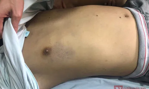 Làm rõ nguyên nhân một bị can tử vong trong quá trình tạm giam ở Hà Nam