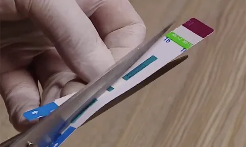Bộ Y tế vào cuộc về vụ việc nhân viên cắt đôi que xét nghiệm HIV, viêm gan B tại bệnh viện Xanh Pôn