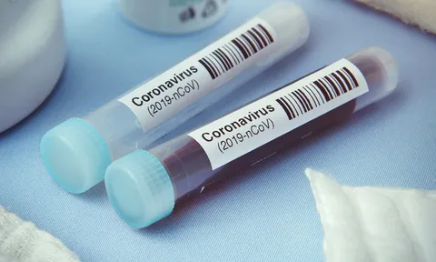 Hà Nội bắt đầu xét nghiệm nhanh Covid-19 trên diện rộng