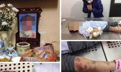 Chủ tịch Hà Nội chỉ đạo điều tra vụ bé 3 tuổi nghi bị mẹ và bố dượng bạo hành tử vong