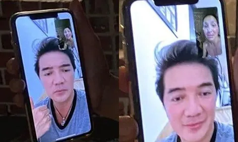 Ca sĩ Hồng Ngọc lộ gương mặt bị bỏng nặng qua màn hình facetime cùng Đàm Vĩnh Hưng
