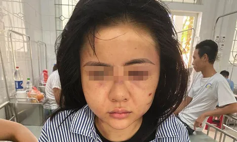Triệu tập gã thanh niên xăm trổ hành hung cô gái suốt 2 giờ ở Yên Bái