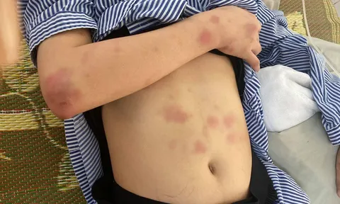 Lời kể của cô gái bị gã thanh niên đánh suốt 2 tiếng vì từ chối tình cảm