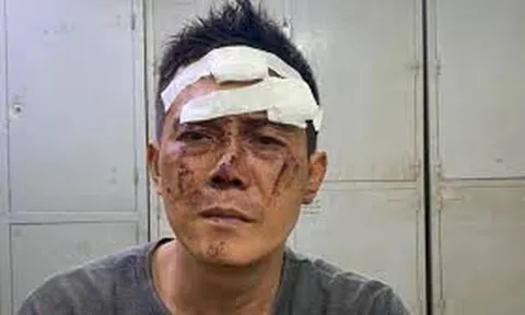 TP.HCM: Khống chế con nghiện dùng kim tiêm uy hiếp để cướp tài sản