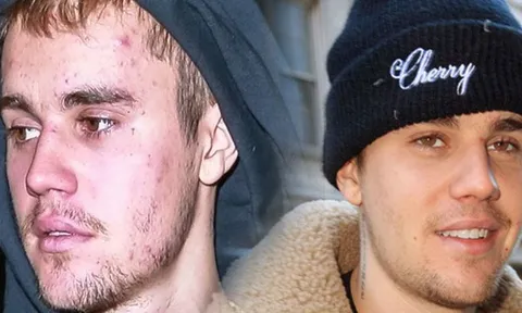Justin Bieber tiết lộ cùng lúc anh bị mắc hai căn bệnh vô cùng đáng sợ