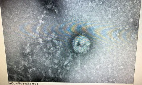 Việt Nam nuôi cấy và phân lập thành công virus corona mới
