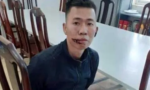 Giám định tâm thần nam thanh niên chém cả gia đình thương vong ở Hà Nội