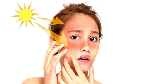 5 mẹo hay giúp bạn đánh bật nám da cực hiệu quả từ thói quen sinh hoạt hằng ngày!