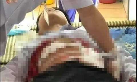 Mâu thuẫn trong lúc trêu đùa, nam sinh lớp 9 lấy dao đâm bạn