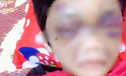 Khởi tố người mẹ hành hạ dã man con gái ruột ở Hải Dương