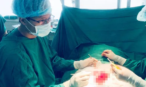 Mâu thuẫn tình cảm, vợ dùng kéo cắt đứt 'của quý' của chồng lúc ngủ say