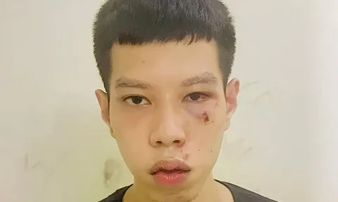 Hà Nội: Bắt giữ đối tượng cướp tiền lương hưu của cụ bà 70 tuổi