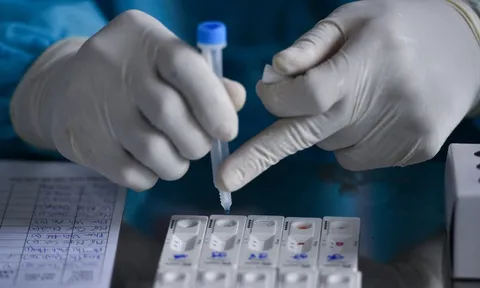TP.HCM chủ trương cho người dân tự test nhanh với COVID-19 tại nhà
