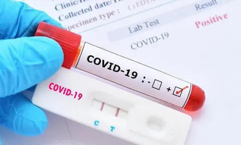 Bộ Y tế đề nghị tăng cường kiểm soát giá dịch vụ chẩn đoán COVID-19