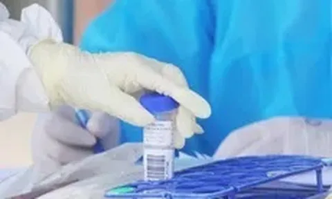 Ngày 18/10, Hà Nội ghi nhận 5 ca mắc COVID-19 đều đã được cách ly