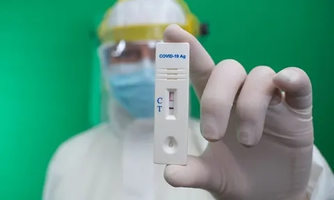 TP.HCM thanh tra, kiểm tra đột xuất việc mua bán kit xét nghiệm