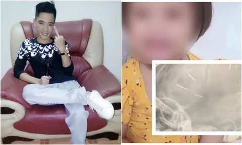Vụ bé 3 tuổi bị găm 9 đinh vào đầu: Lạnh người những trận đòn roi của gã người tình