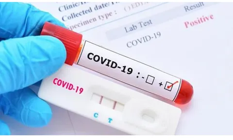 Cơ sở y tế tư nhân không được lợi dụng dịch bệnh để tăng giá xét nghiệm COVID-19
