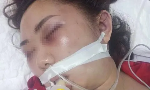 Cô gái 22 tuổi tử vong, nghi bị bạn trai đánh