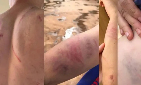 Xác minh thông tin cháu bé 9 tuổi nghi bị cha và bà nội đánh đập